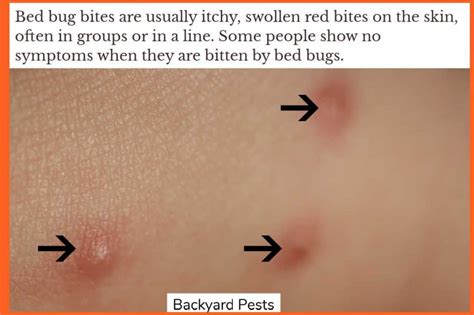 Signs Of Bed Bugs With Pictures And Video Backyard Pests