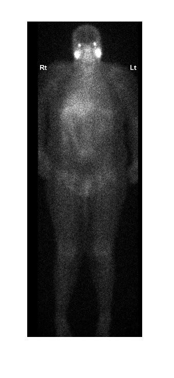 Imaging Case Of The Week 393 Emergucate