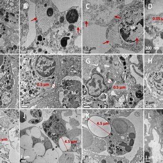 Tem Images Showing The Intracellular Localization Of Nps And Mps In