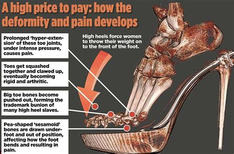 Physiological Challenges Of Wearing High Heel Shoes