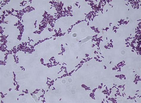 Bacillus Subtilis Gram Stain Microbiology Pinterest