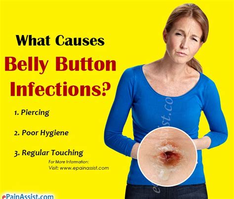 Fungal Infection Belly Button