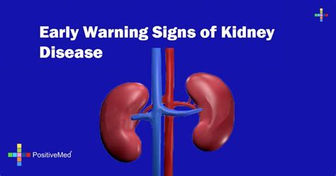 Early Warning Signs Of Kidney Disease