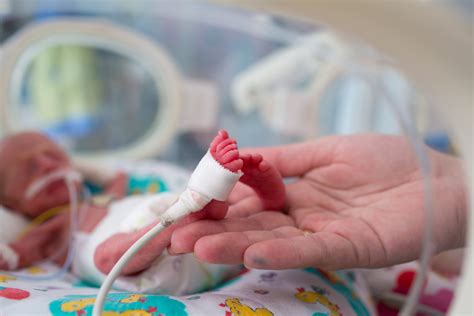 Most Common Premature Baby Complications Causes And Treatment Herapedia