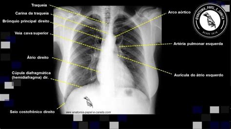 Anatomia radiológica do tórax Anatomia radiologica Anatomia Papel e