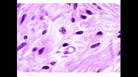 Fibroblastos Y Fibrocitos Tejidos Básicos Curso En Línea 2 008