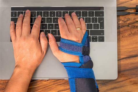 Right Hand Carpal Tunnel Hand Support Hand Suffering From Repetitive