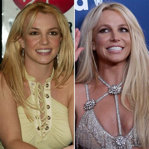 Czy Britney Spears Przeszła Operację Plastyczną Zobacz Zdjęcia Jej Transformacji Aktualnościnews