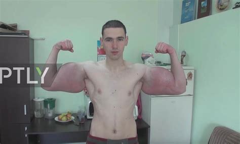 Heres The Story Behind That Russian Synthol Freak Thats Been Going Viral