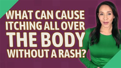 What Can Cause Itching All Over The Body Without A Rash Youtube