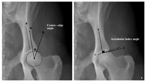 Ventrodorsal Pelvic Radiograph Of A Normal Coxofemoral Joint