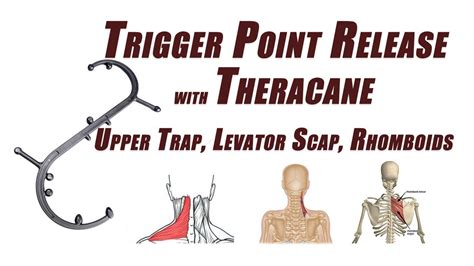Trigger Point Release In The Upper Trapezius Levator Scapulae And
