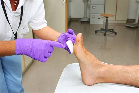 Best Foot Wound Stock Photos Pictures And Royalty Free Images Istock