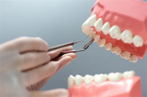 ¿qué Es El Curetaje Dental Odontocenter
