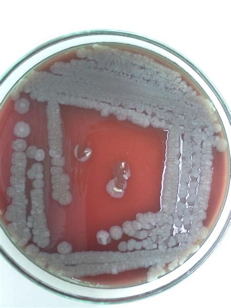 Bacillus Spp Microbiology Microbiology Lab Bacillus