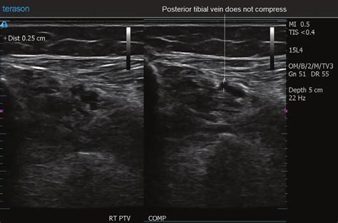 This 49 Year Old Woman Returned In Follow Up 6 Days After Surgery Her Download Scientific