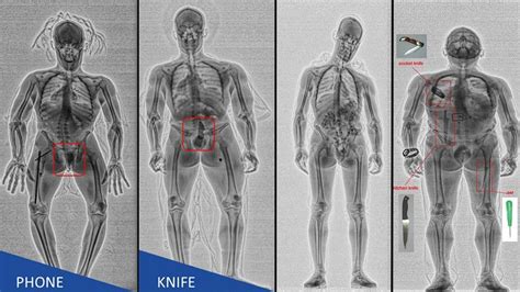 Body Scanner Arrives At Jail