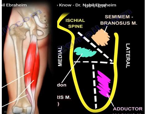 Anatomy Of The Semitendinosus Muscle —