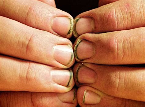 How Your Fingernails Change As You Age Fingernails Teacher Must