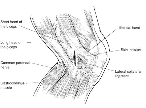 Lateral Knee Anatomy