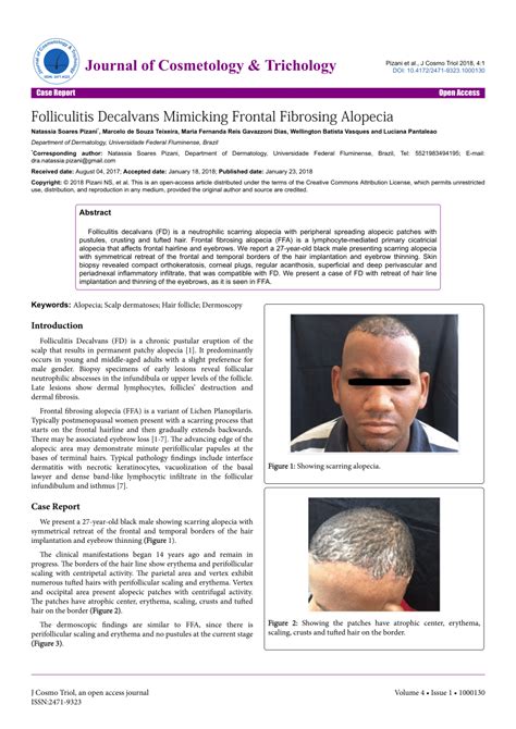 Pdf Folliculitis Decalvans Mimicking Frontal Fibrosing Alopecia