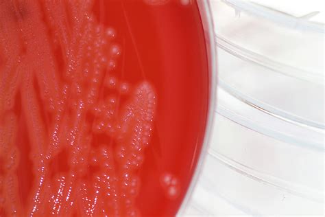 Streptococcus Agalactiae Bacteria Culture Photograph By Daniela