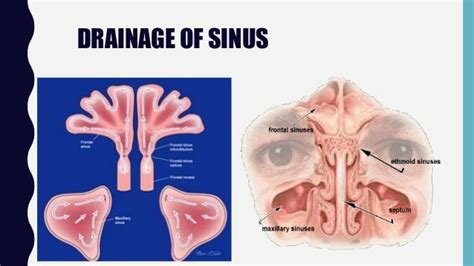 Surgical Anatomy Of Maxillary Sinus