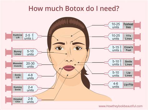 Botox Around Mouth Say Goodbye To Wrinkles Does It Work