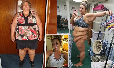 Illinois Obese Mother Sheds 180lb Thanks To Therapy Daily Mail Online