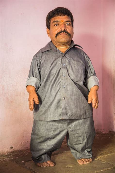 Nine Out Of Members Of Family Are Dwarfs Due To Rare Genetic Condition Causing Short Limbs