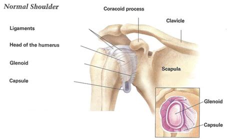 Deltoid trigger points can be aching or deep and throbbing. Recalcitrant & Frozen Shoulder | Dr Skedros Orthopaedics