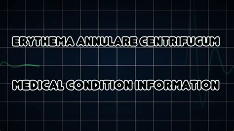 Erythema Annulare Centrifugum Medical Condition Youtube