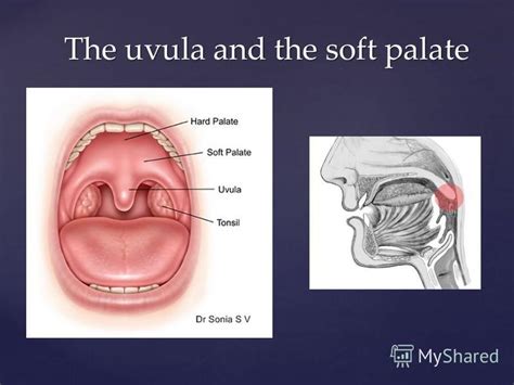 The Palate Hard Palate Soft Palate Uvula Teachmeanatomy Images And Photos Finder