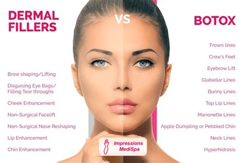 Your Health Now Differences Between Botox And Fillers The Best Porn Website