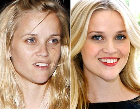 Reese Witherspoon Alot Of Red Blotches In Her Skin Chin Forehead Dark Circles Under H