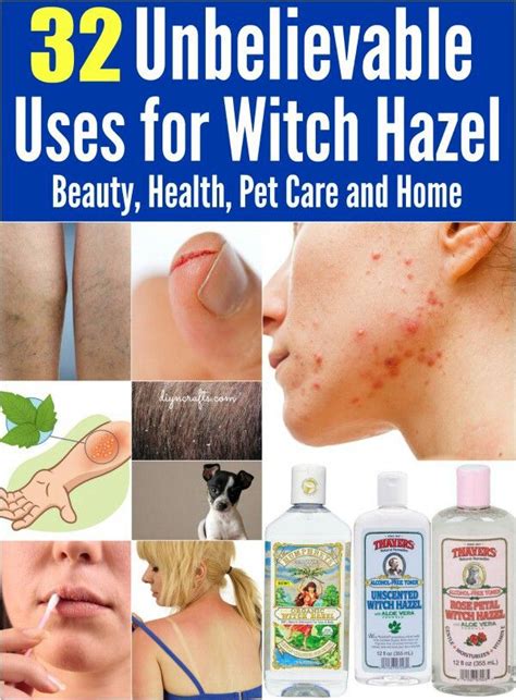 Pin By Gwen Smith On Beauty Tips Witch Hazel Uses Health And Beauty