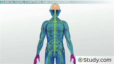 It can cause muscle weakness, reflex loss, and numbness or tingling in parts of your body. Guillain-Barre Syndrome: Sudden Paralysis - Video & Lesson Transcript | Study.com