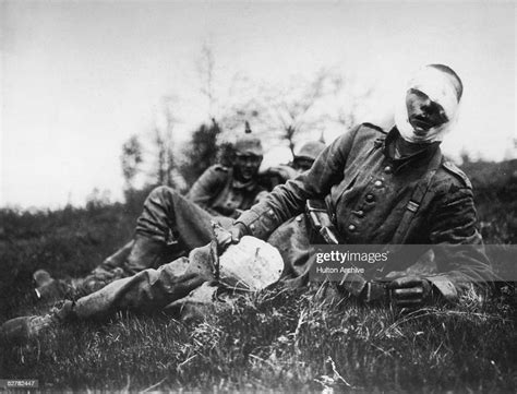 A Wounded German Soldier 18th May 1915 News Photo Getty Images