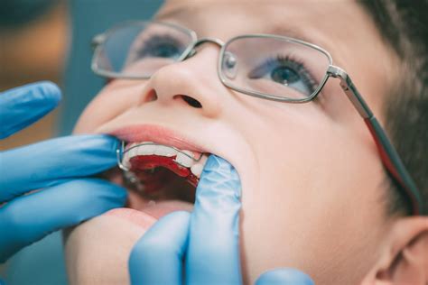 Eric Davis Dental The Differences Between Orthotropics And Orthodontics