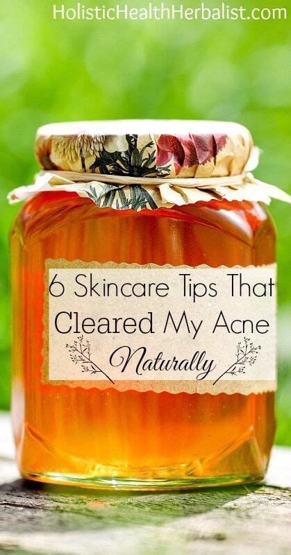 6 Skincare Tips That Cleared My Acne Naturally Learn About My Top Acne