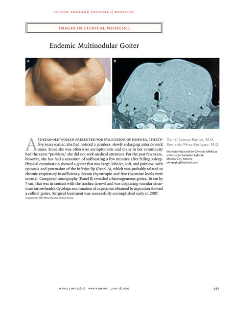 Pdf Images In Clinical Medicine Endemic Multinodular Goiter