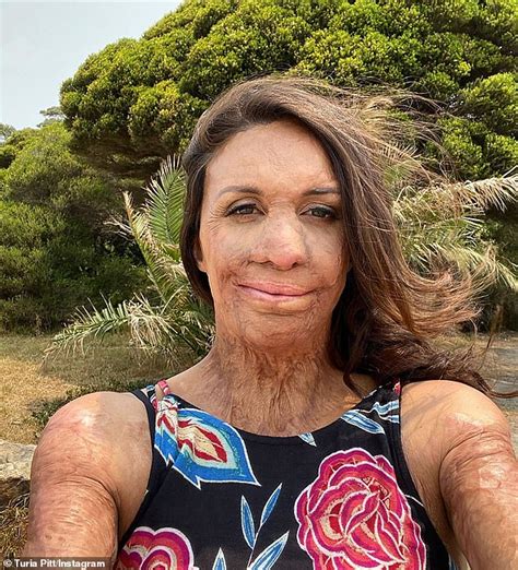 Turia Pitt Shares An Adorable Throwback Of Herself After Achieving Her Dream Of Owning A
