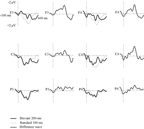 Grand Average Event Related Potentials Erps Averaged Across 10