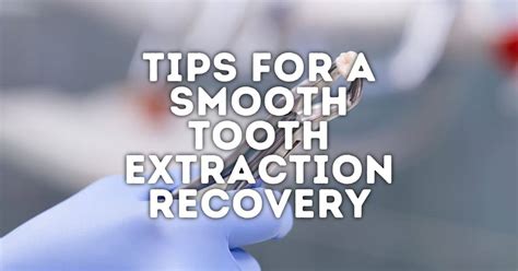 10 Tips For A Smooth Tooth Extraction Recovery