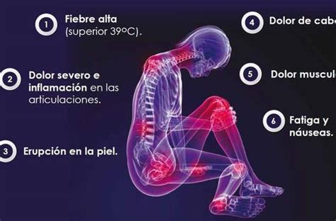 May 06, 2017 · • no puede tomar o beber líquidos. Las señales de chikungunya - Paraguay.com