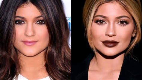 13 Of The Most Drastic Celebrity Plastic Surgeries Bad Plastic Surgeries Plastic Surgery Gone
