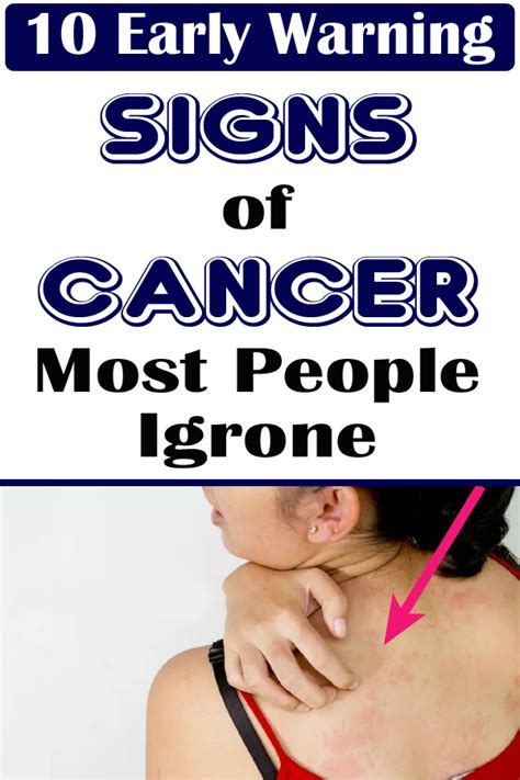 10 Early Warning Signs Of Cancer Most People Ignore