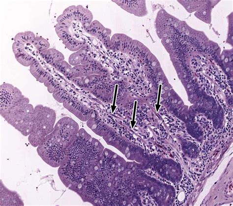 Small And Large Intestine Histology