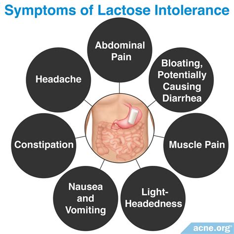 Does Lactose Intolerance Relate To Acne