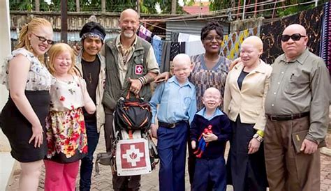 Health And Albinism Positive Exposure Kenya